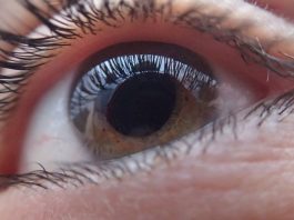 Diagnosticos de retinopatía diabetica mediante una IA