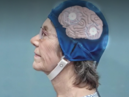 Casco que elimina Alzheimer